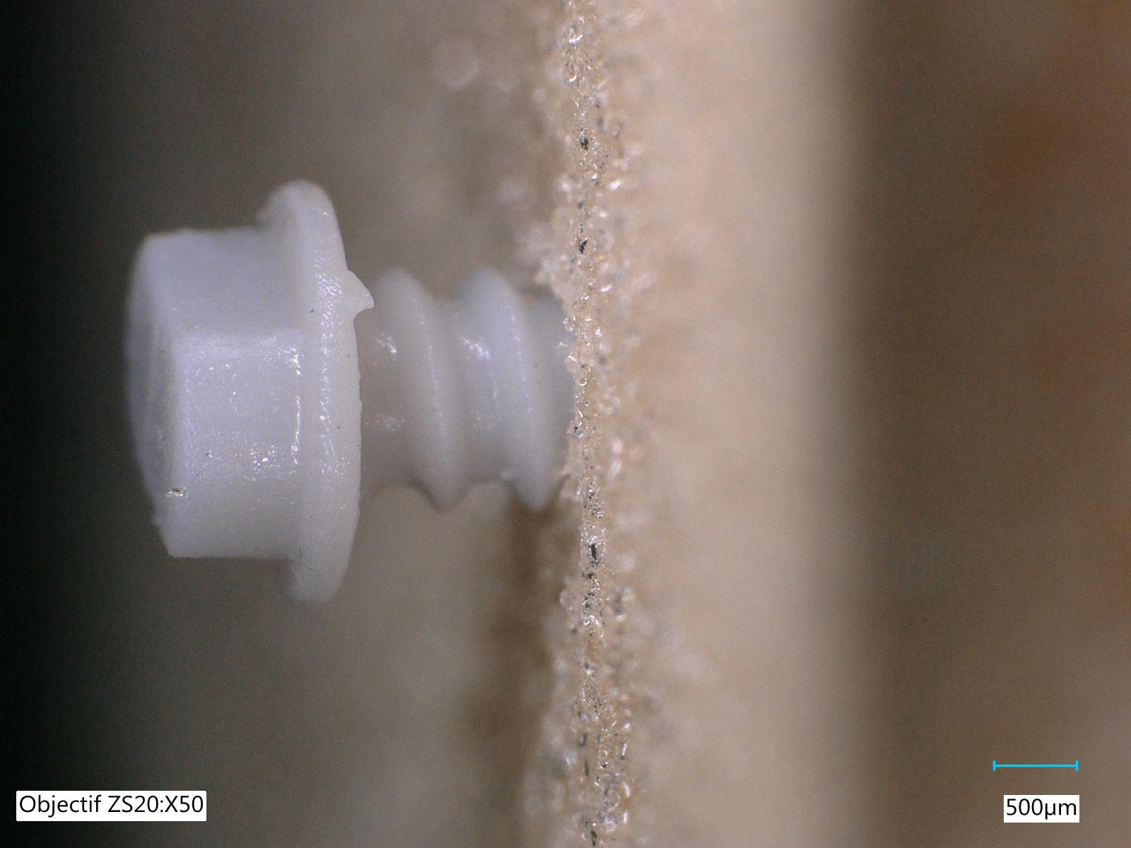 CRITT-MI AntiRési surfaces antibactériennes céramiques métaux polymères antibiorésistance santé Interreg